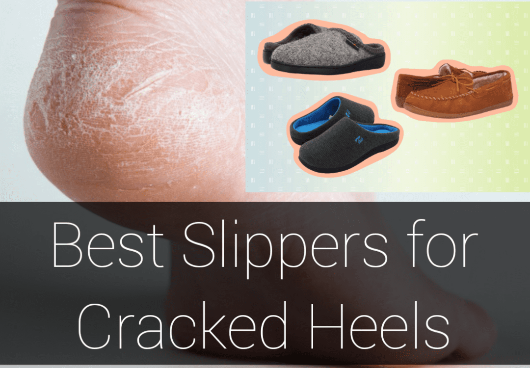 10 Best Slippers for Cracked Heels