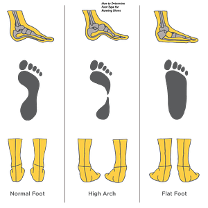 How to Determine Foot Type for Running Shoes