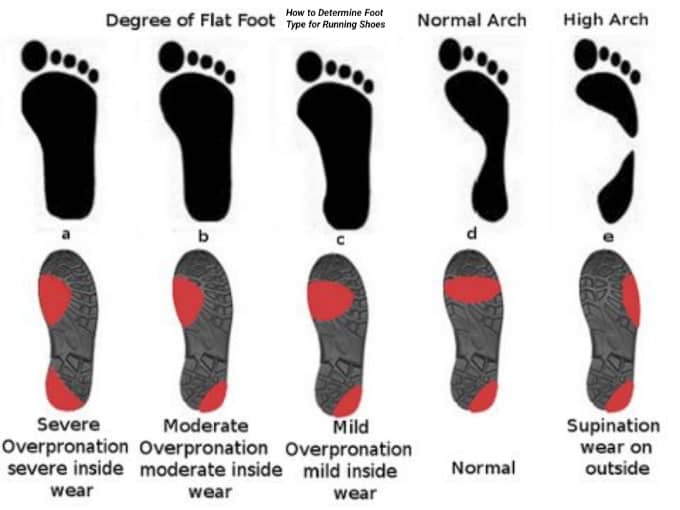 How to Determine Foot Type for Running Shoes